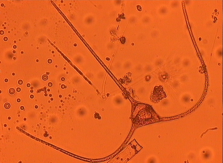 Dictyocha speculum